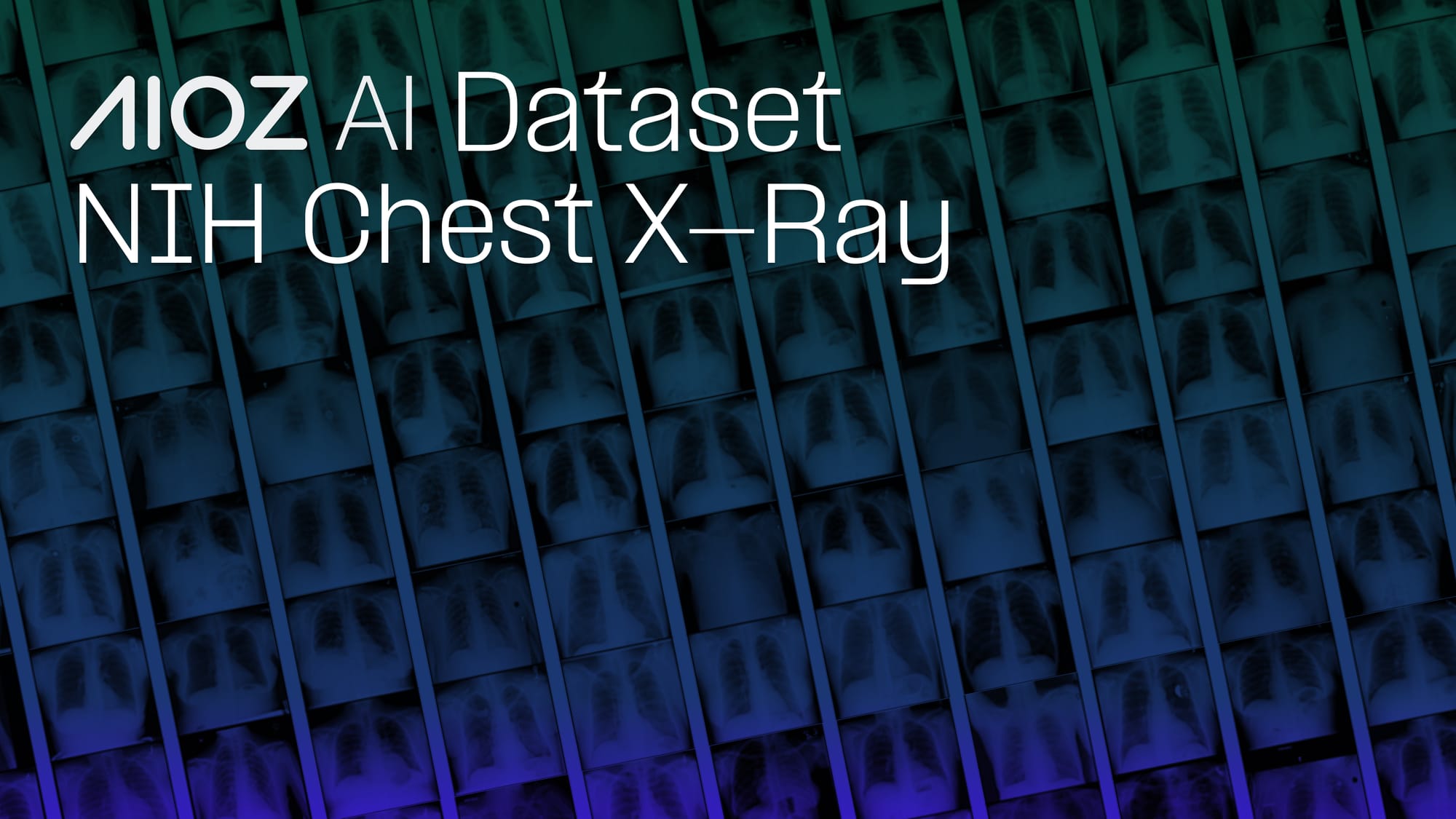 NIH Chest X-Ray: Frontal Images for Multi-Disease Detection